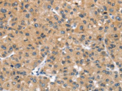 UCP3 Antibody