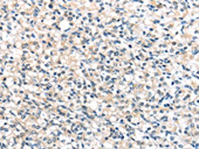 UCP3 Antibody