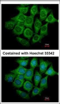 UBE4B antibody [C2C3], C-term
