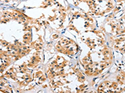 UGCG Antibody