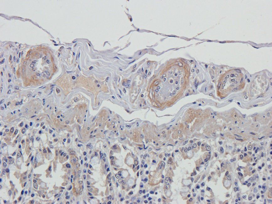 UGT1A1 antibody