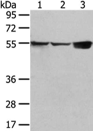 UGT1A10 antibody