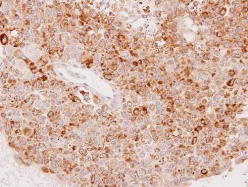 UGT1A6 antibody