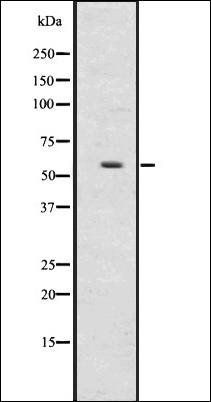 UGT2B antibody