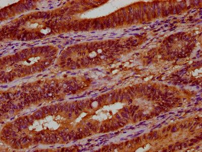 UGT2B7 Antibody