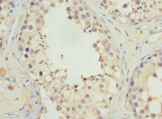 UGT3A2 Antibody