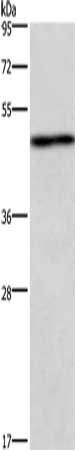 UHMK1 Antibody