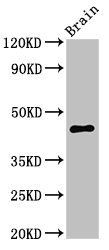 UHMK1 Antibody