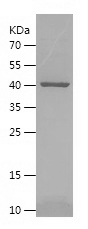 Human SerpinB8 protein