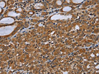 UHRF2 Antibody