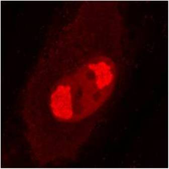 Anti-UL56 (HCMV) antibody