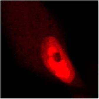 UL89 (HCMV) antibody