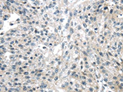 ULBP1 antibody