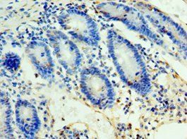ULBP2 Antibody