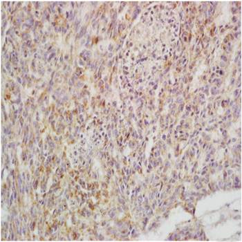 ULBP3 Rabbit Polyclonal Antibody