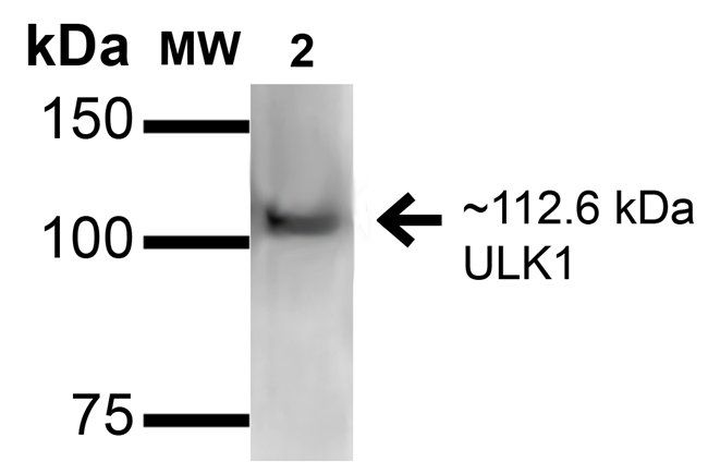ULK1 Antibody