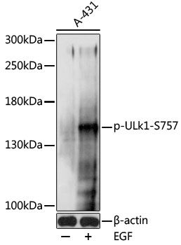 ULk1 (Phospho-S757) antibody