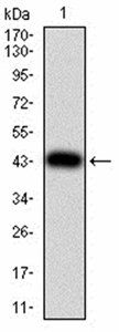 ULK2 Antibody