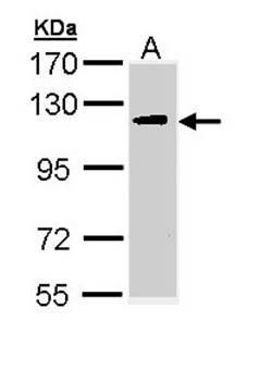 ULK2 antibody