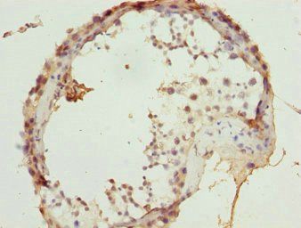 ULK4 Antibody