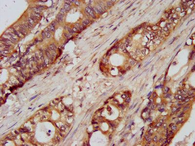 UMPS Antibody