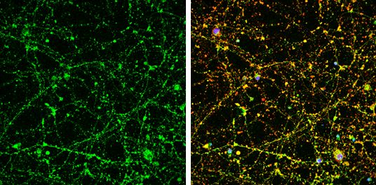 UNC13B antibody [N3C1], Internal
