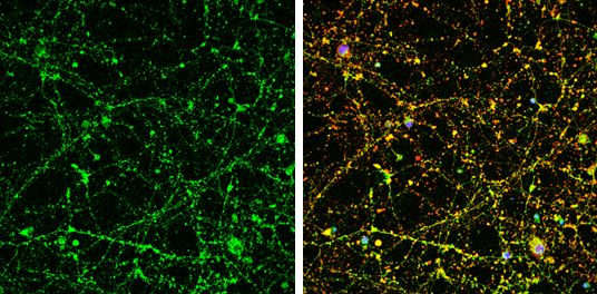 UNC13B antibody