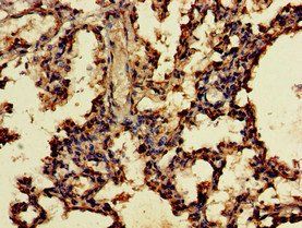 UNC13D Antibody
