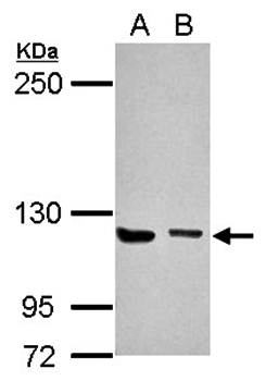 UNC13D antibody