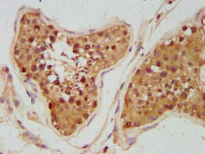 UNC5B Antibody