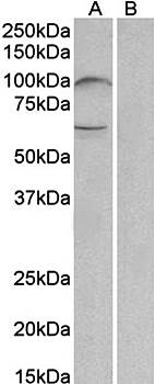 Goat anti-UNC5B (aa629-643) Antibody