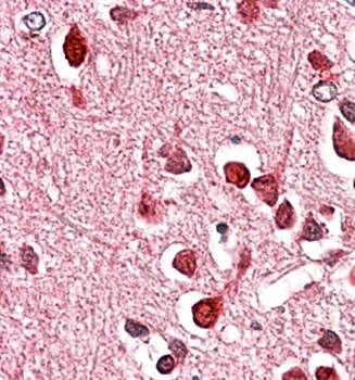 Goat anti-UNC5C Antibody