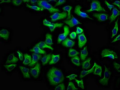 UNC5D Antibody