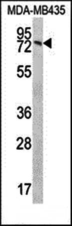 UNC84B antibody