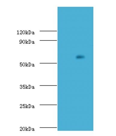 Uncharacterized aarF domain-containing protein kinase 2 antibody