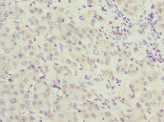 UPF2 Antibody