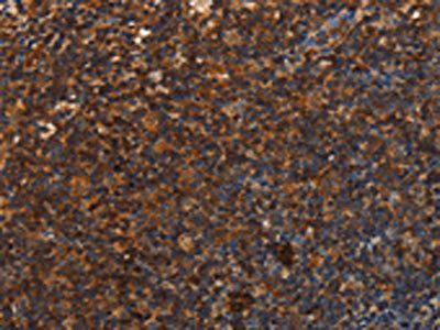 UPK3B Antibody