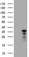 UPRT antibody