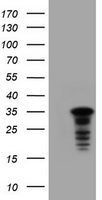 UPRT antibody