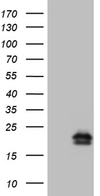 Upstream Binding Protein 1 (UBP1) antibody