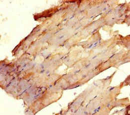 Upstream stimulatory factor 1 antibody