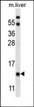 UQCRB antibody