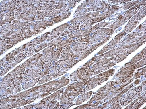 UQCRC1 Rabbit Polyclonal Antibody
