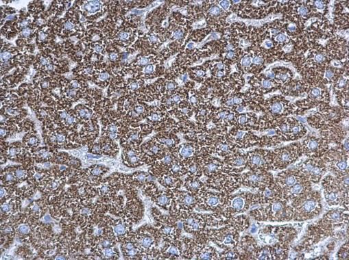 UQCRC1 Rabbit Polyclonal Antibody
