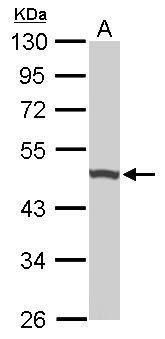UQCRC1 Rabbit Polyclonal Antibody