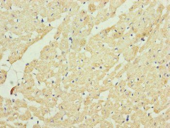 UQCRC2 Antibody