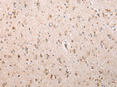 UQCRC2 Antibody