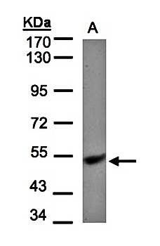 ubiquinol-cytochrome c reductase core protein I precursor antibody