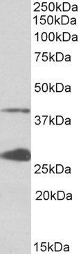 Goat anti-UROD Antibody