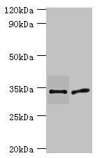Urokinase plasminogen activator surface R antibody